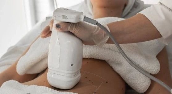 Ultrasound aesthetic treatment